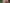 Banner Postoperatieve Pijn Aangepast 1000Px