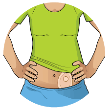 Stomamateriaal En Hulpmiddelen